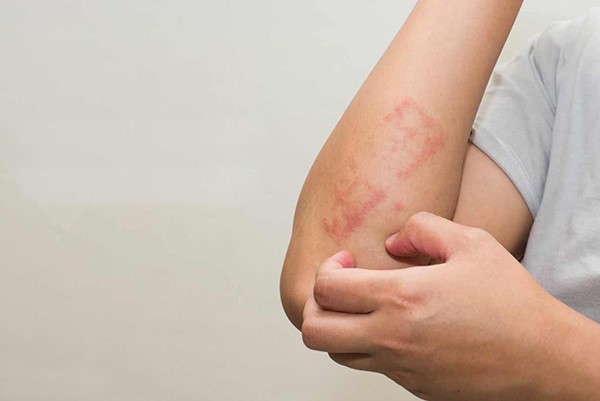 Tác dụng phụ của hạt macca